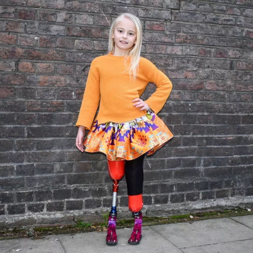 无腿女孩火遍外网她先天残疾却凭一己之力拯救了整个家庭